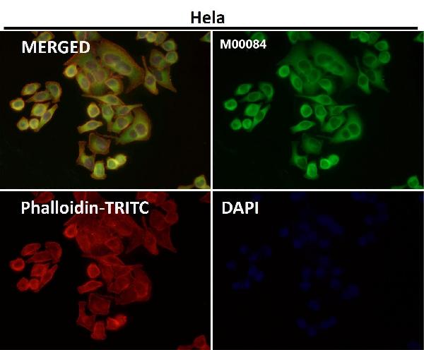 1 - Anti-COX2 PTGS2 Rabbit Monoclonal Antibody ABO13393