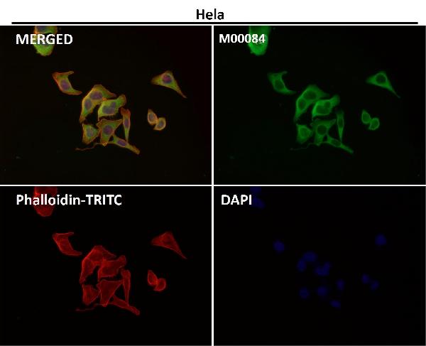 1 - Anti-COX2 PTGS2 Rabbit Monoclonal Antibody ABO13393