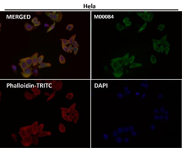1 - Anti-COX2 PTGS2 Rabbit Monoclonal Antibody ABO13393
