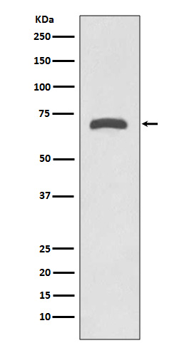 1 - Anti-MMP8 Rabbit Monoclonal Antibody ABO13395