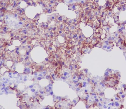 2 - Anti-AQP5 Rabbit Monoclonal Antibody ABO13396
