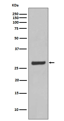 1 - Anti-AQP5 Rabbit Monoclonal Antibody ABO13396