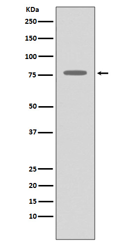 1 - Anti-GRK2 ADRBK1 Rabbit Monoclonal Antibody ABO13397