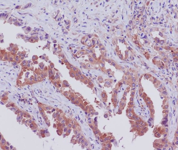 2 - Anti-SGK1/Sgk Rabbit Monoclonal Antibody ABO13398