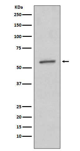 1 - Anti-SGK1/Sgk Rabbit Monoclonal Antibody ABO13398
