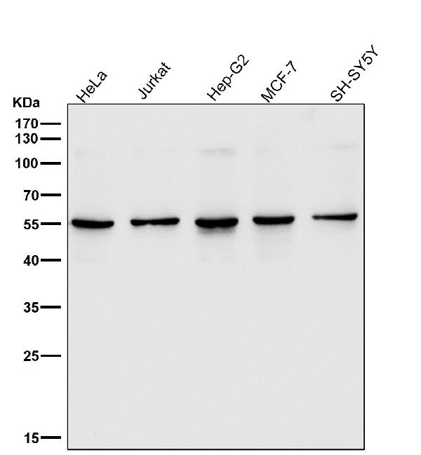 1 - Anti-SGK1/Sgk Rabbit Monoclonal Antibody ABO13398