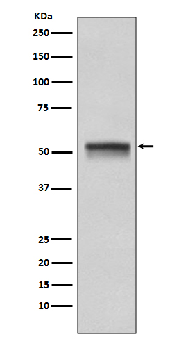 1 - Anti-Chk1 CHEK1 Rabbit Monoclonal Antibody ABO13399