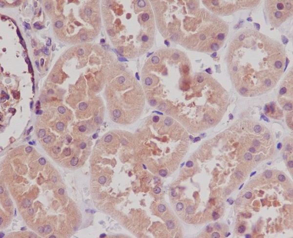 2 - Anti-STK3/Mst2 Rabbit Monoclonal Antibody ABO13400