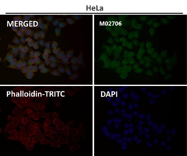 1 - Anti-JNK2 MAPK9 Rabbit Monoclonal Antibody ABO13401