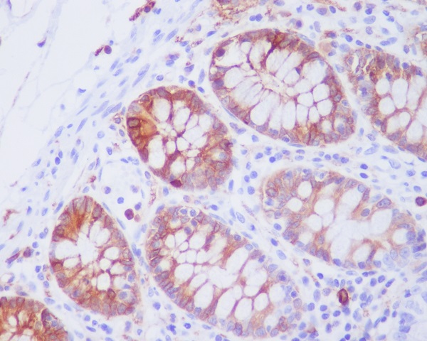 2 - Anti-JNK2 MAPK9 Rabbit Monoclonal Antibody ABO13401