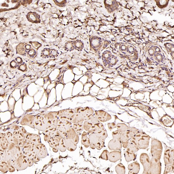 2 - Anti-JNK2 MAPK9 Rabbit Monoclonal Antibody ABO13401