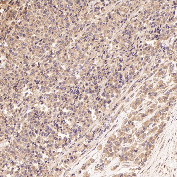2 - Anti-JNK2 MAPK9 Rabbit Monoclonal Antibody ABO13401