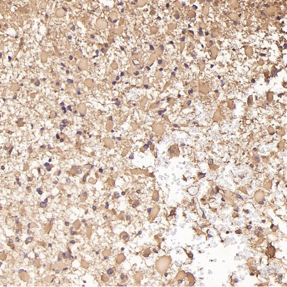 2 - Anti-JNK2 MAPK9 Rabbit Monoclonal Antibody ABO13401