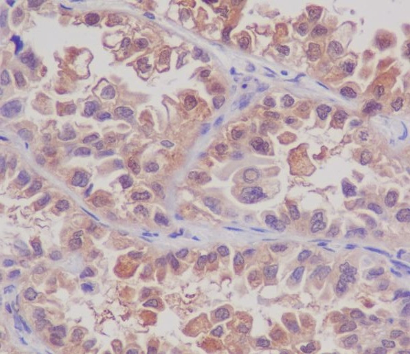 2 - Anti-MSI2/Musashi 2 Rabbit Monoclonal Antibody ABO13402