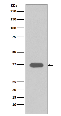 1 - Anti-MSI2/Musashi 2 Rabbit Monoclonal Antibody ABO13402