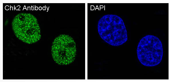 3 - Anti-Chk2 CHEK2 Rabbit Monoclonal Antibody ABO13403