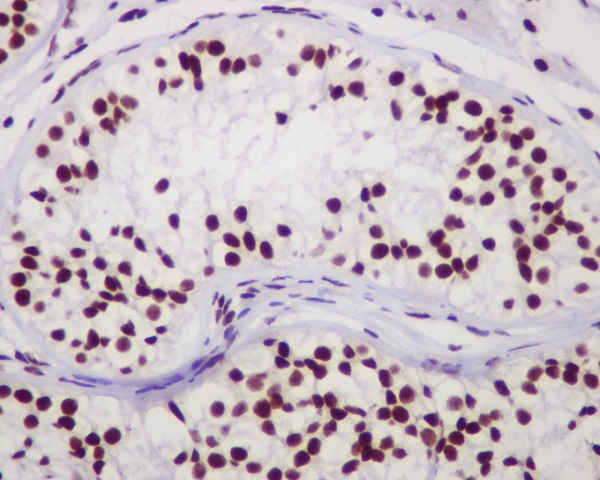 2 - Anti-Chk2 CHEK2 Rabbit Monoclonal Antibody ABO13403
