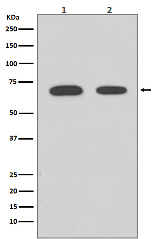 1 - Anti-Chk2 CHEK2 Rabbit Monoclonal Antibody ABO13403