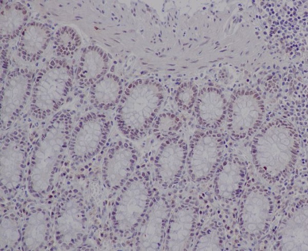 2 - Anti-Ku80 XRCC5 Rabbit Monoclonal Antibody ABO13405