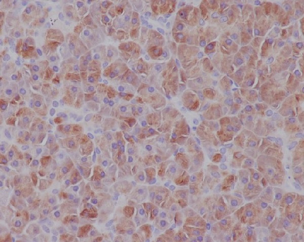 2 - Anti-IRF7 Rabbit Monoclonal Antibody ABO13406
