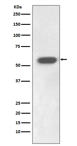 1 - Anti-IRF7 Rabbit Monoclonal Antibody ABO13406