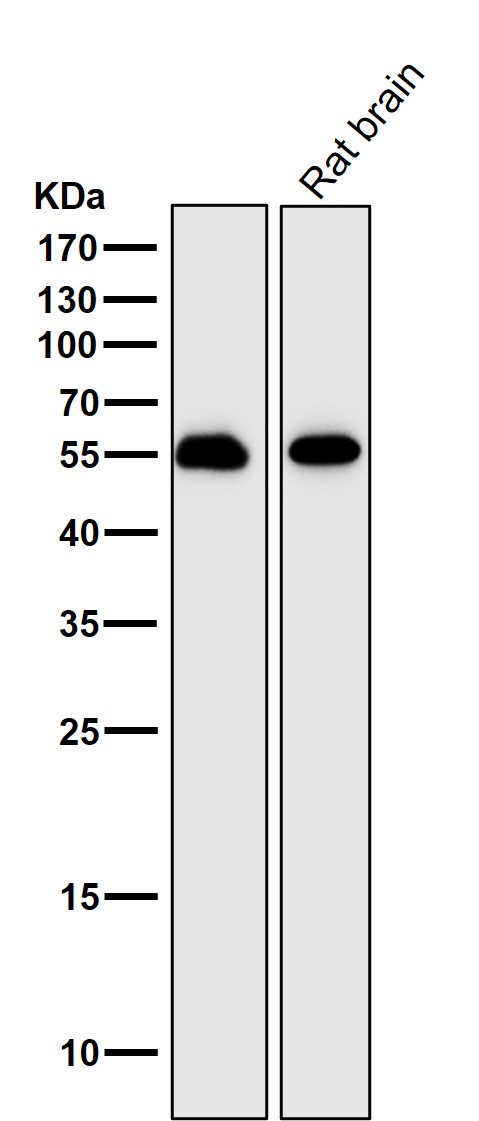 1 - Anti-IRF7 Rabbit Monoclonal Antibody ABO13406