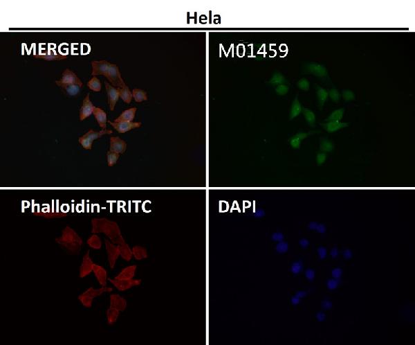 1 - Anti-Hes1 Rabbit Monoclonal Antibody ABO13407