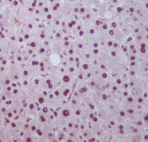 2 - Anti-Hes1 Rabbit Monoclonal Antibody ABO13407
