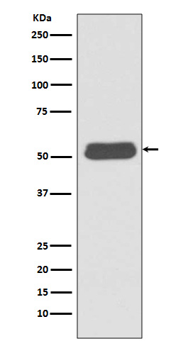1 - Anti-LSP1 Rabbit Monoclonal Antibody ABO13408
