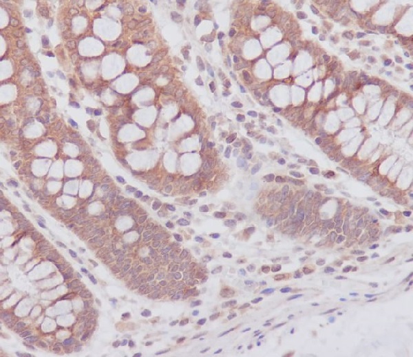 2 - Anti-ATG7/Apg7 Rabbit Monoclonal Antibody ABO13409