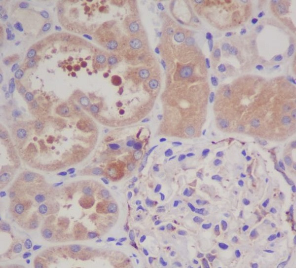 2 - Anti-GARS Rabbit Monoclonal Antibody ABO13411
