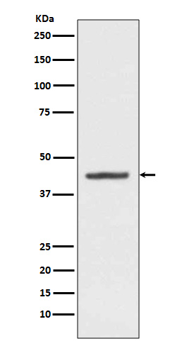 1 - Anti-HMBS Rabbit Monoclonal Antibody ABO13412
