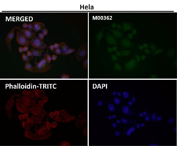 1 - Anti-TMS1 PYCARD Rabbit Monoclonal Antibody ABO13413