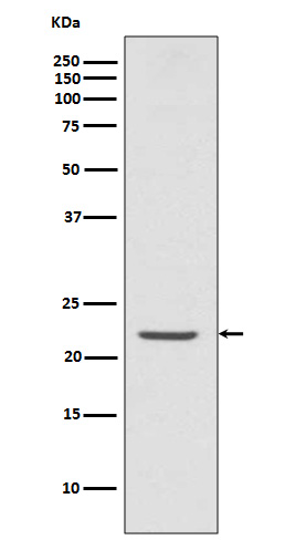 1 - Anti-TMS1 PYCARD Rabbit Monoclonal Antibody ABO13413
