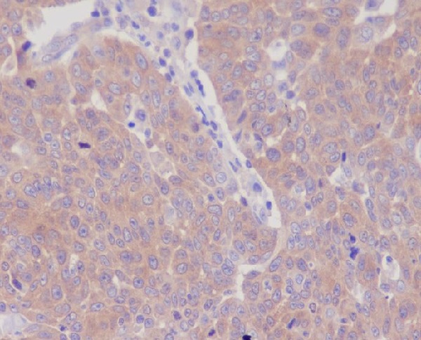 2 - Anti-GART Rabbit Monoclonal Antibody ABO13414