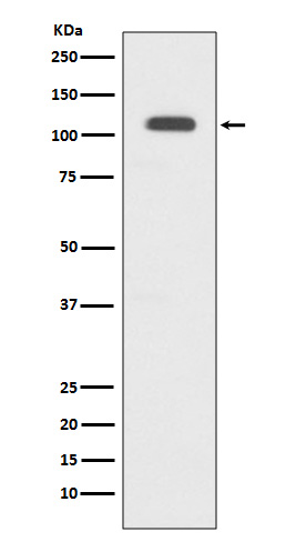 1 - Anti-GART Rabbit Monoclonal Antibody ABO13414