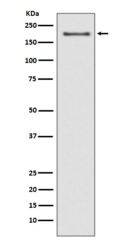 1 - Anti-NSD3/WHSC1L1 Rabbit Monoclonal Antibody ABO13415