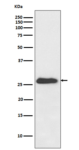 1 - Anti-NQO2 Rabbit Monoclonal Antibody ABO13416