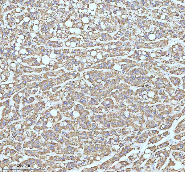 2 - Anti-CPT2 Rabbit Monoclonal Antibody ABO13417