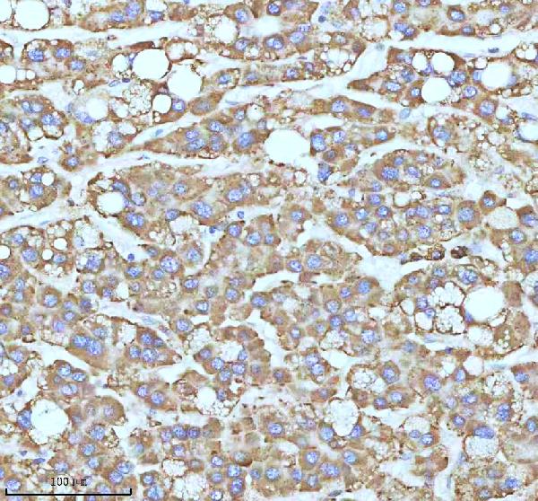 2 - Anti-CPT2 Rabbit Monoclonal Antibody ABO13417