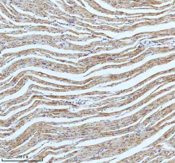 2 - Anti-CPT2 Rabbit Monoclonal Antibody ABO13417