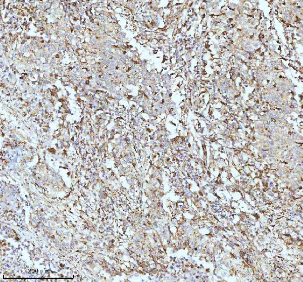 2 - Anti-CPT2 Rabbit Monoclonal Antibody ABO13417
