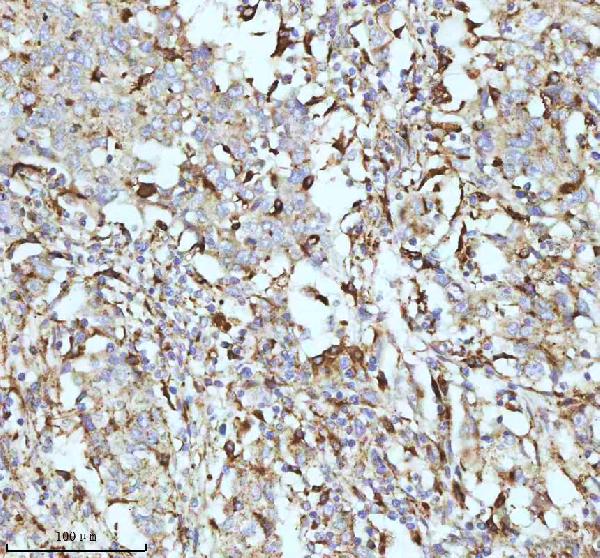 2 - Anti-CPT2 Rabbit Monoclonal Antibody ABO13417