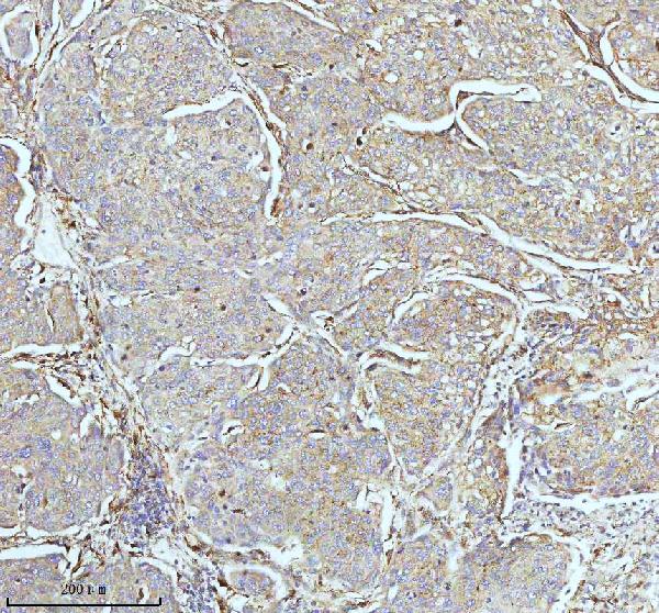 2 - Anti-CPT2 Rabbit Monoclonal Antibody ABO13417