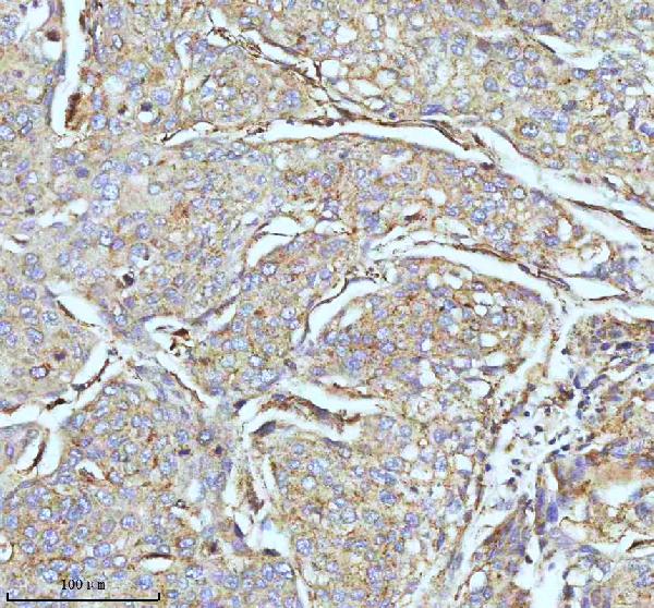 2 - Anti-CPT2 Rabbit Monoclonal Antibody ABO13417