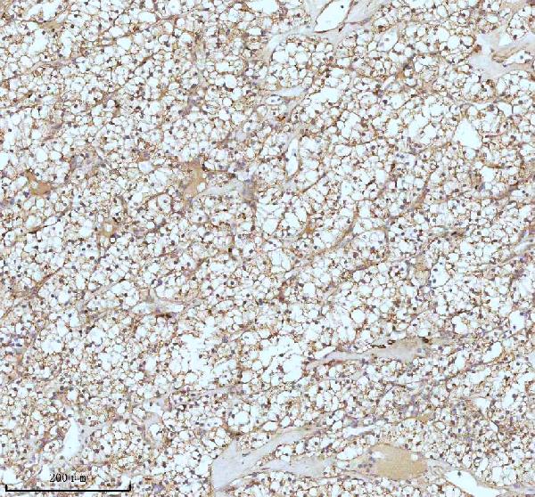2 - Anti-CPT2 Rabbit Monoclonal Antibody ABO13417