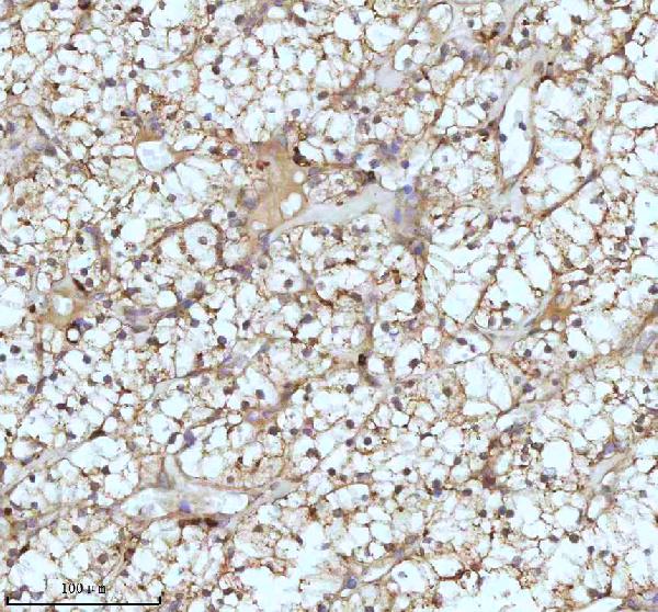 2 - Anti-CPT2 Rabbit Monoclonal Antibody ABO13417