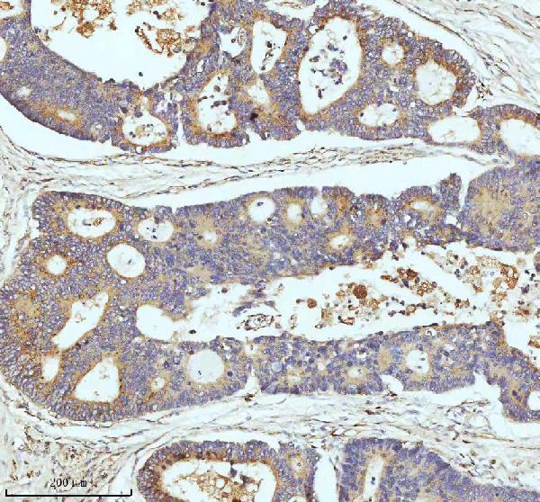 2 - Anti-CPT2 Rabbit Monoclonal Antibody ABO13417
