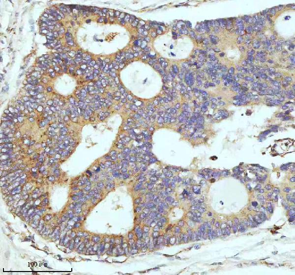 2 - Anti-CPT2 Rabbit Monoclonal Antibody ABO13417