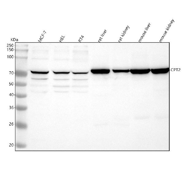 1 - Anti-CPT2 Rabbit Monoclonal Antibody ABO13417